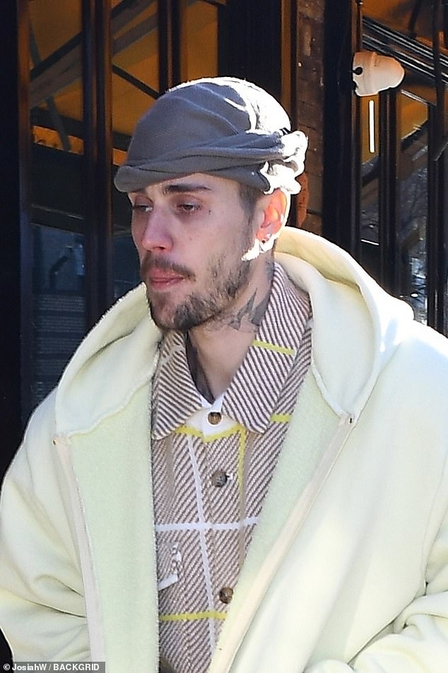 Justin Bieber fans expressed concern about the singer's health this week after he was pictured looking somber and fatigued , his eyes hollow and distant (pictured above in 2025)